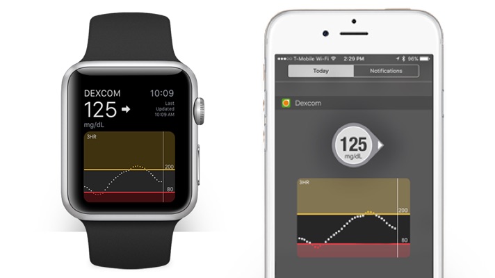 Dexcom s next generation Apple Watch CGM app needs one less device